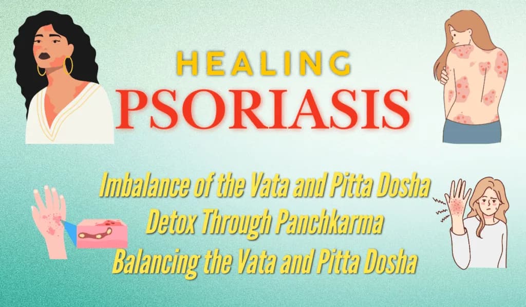Ayurvedic treatment for Psoriasis
